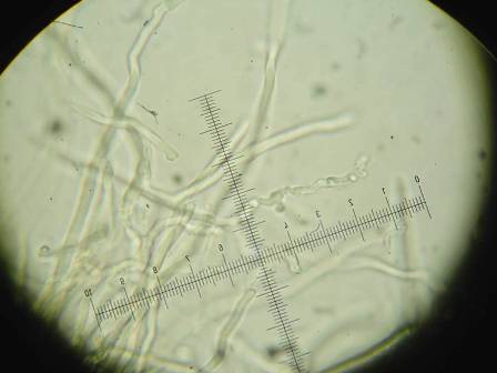 Da determinare (Antrodia albida)